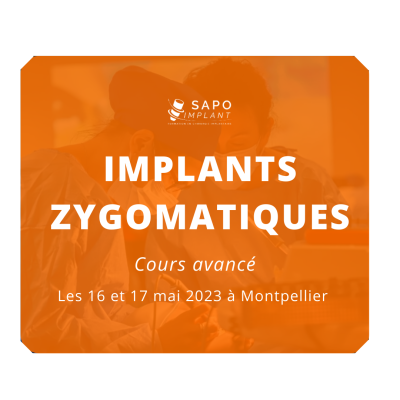 Visuel post RS implants zygomatiques